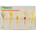 EN-M6 Best Preis Dental Pulp Disease Klinisches Modell vom Hersteller direkt